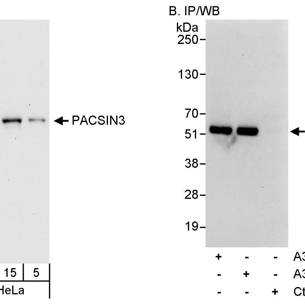 Rabbit anti-PACSIN3 Antibody, Affinity Purified
