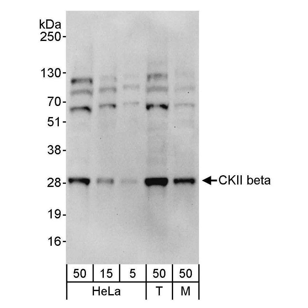 Rabbit anti-CKII beta Antibody, Affinity Purified