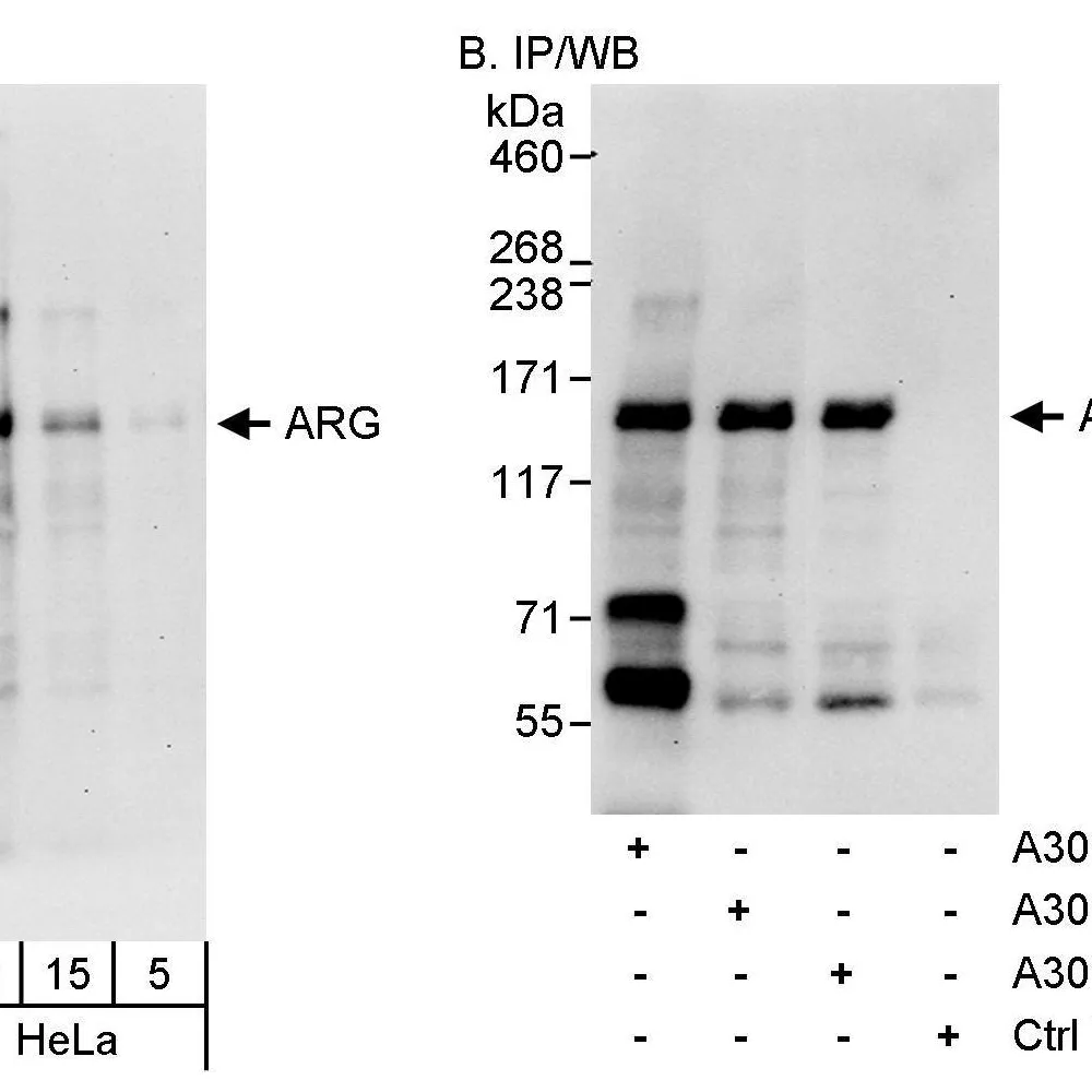 Rabbit anti-ARG Antibody, Affinity Purified