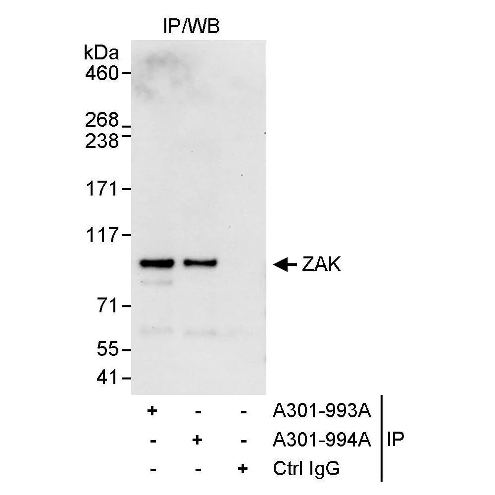Rabbit anti-ZAK Antibody, Affinity Purified