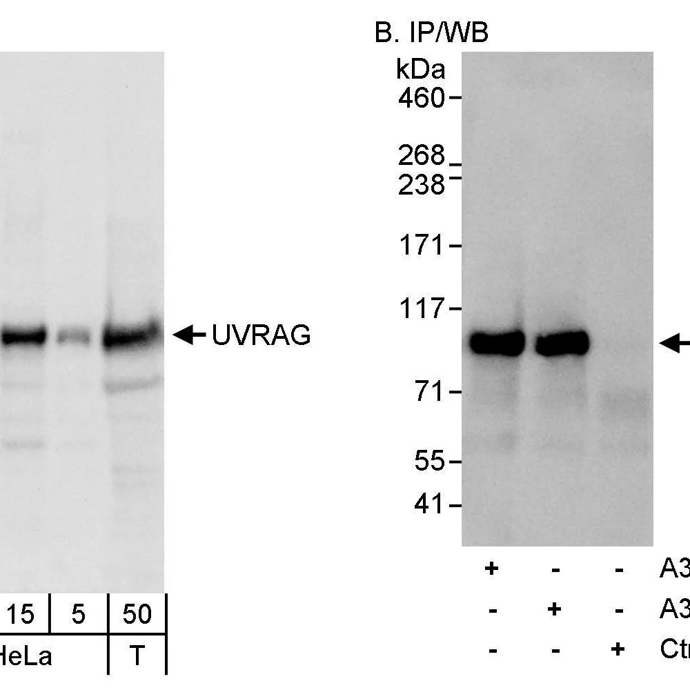 Rabbit anti-UVRAG Antibody, Affinity Purified