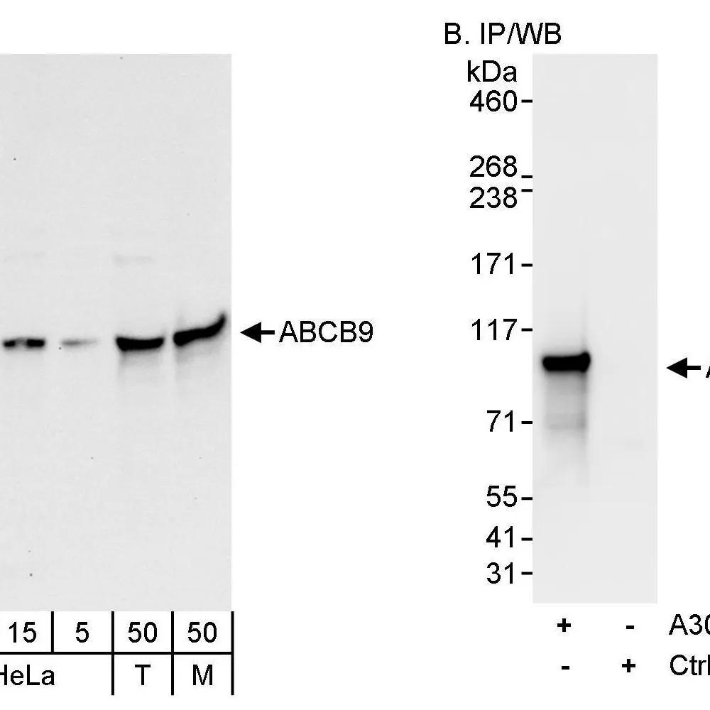 Rabbit anti-ABCB9 Antibody, Affinity Purified