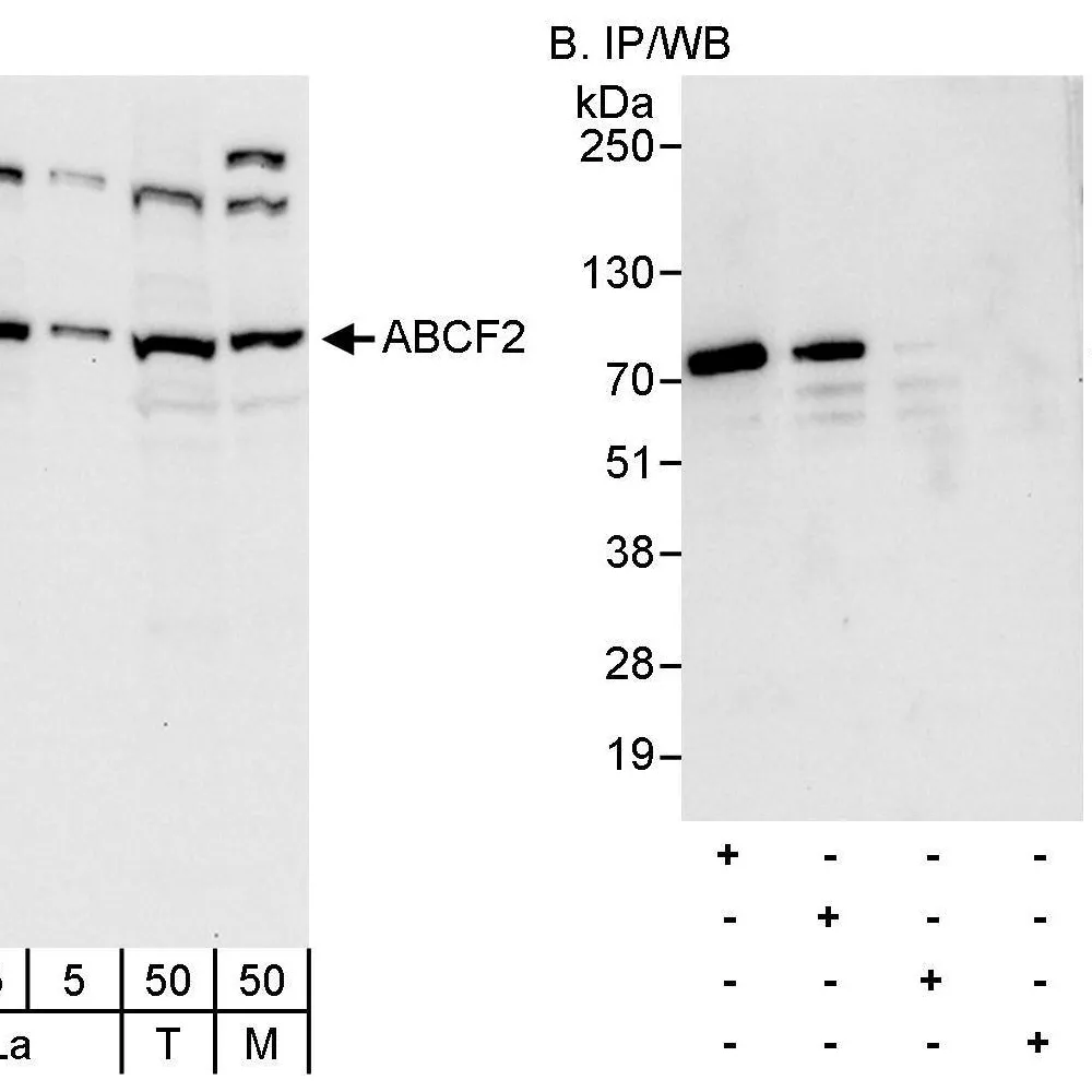 Rabbit anti-ABCF2 Antibody, Affinity Purified