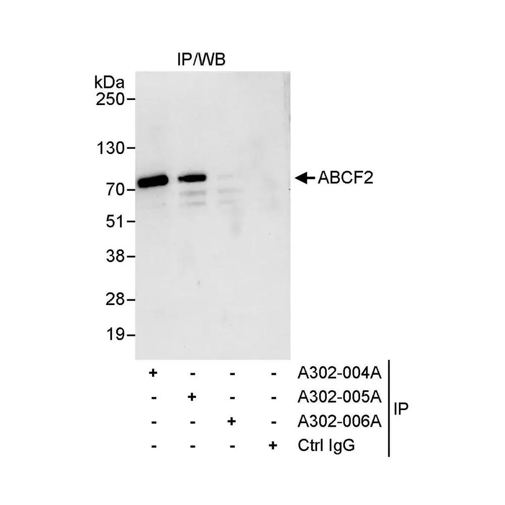 Rabbit anti-ABCF2 Antibody, Affinity Purified