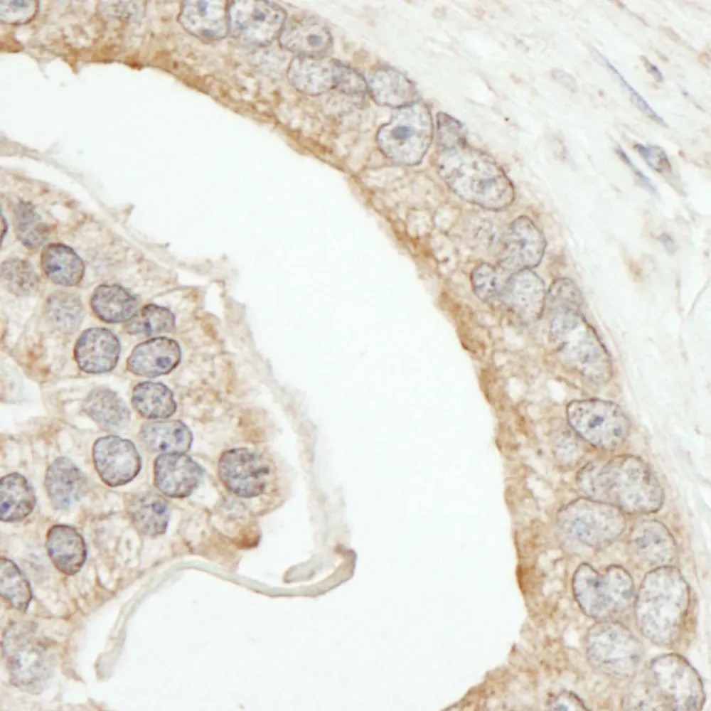 Rabbit anti-ABCF2 Antibody, Affinity Purified
