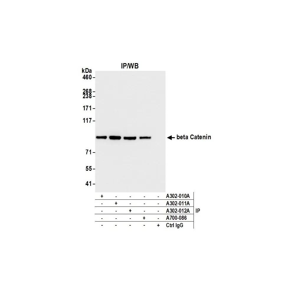 Rabbit anti-beta Catenin Antibody, Affinity Purified