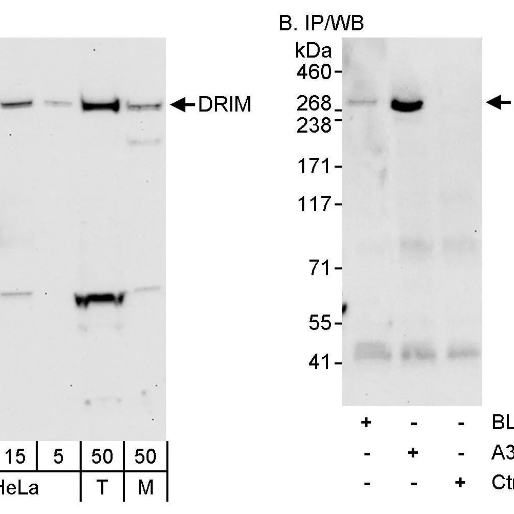 Rabbit anti-DRIM Antibody, Affinity Purified