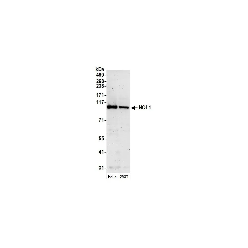 Rabbit anti-NOL1 Antibody, Affinity Purified