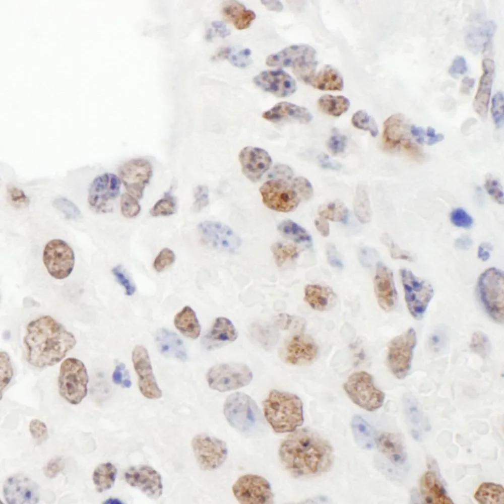 Rabbit anti-KSRP Antibody, Affinity Purified