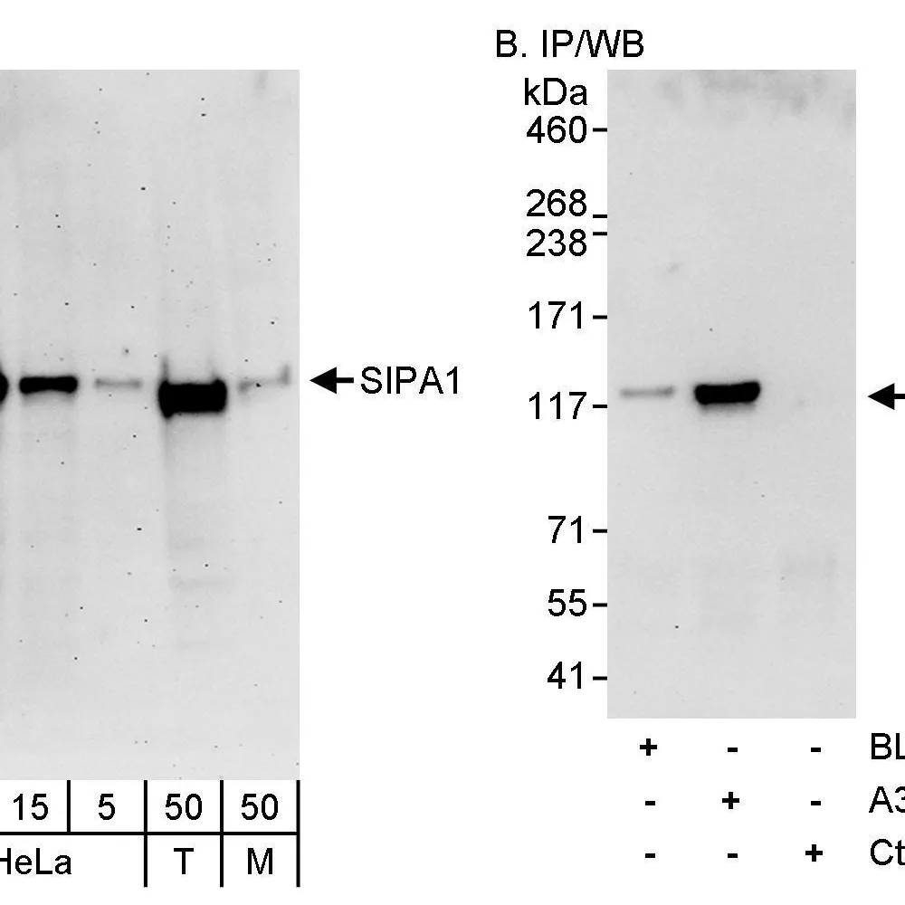 Rabbit anti-SIPA1 Antibody, Affinity Purified