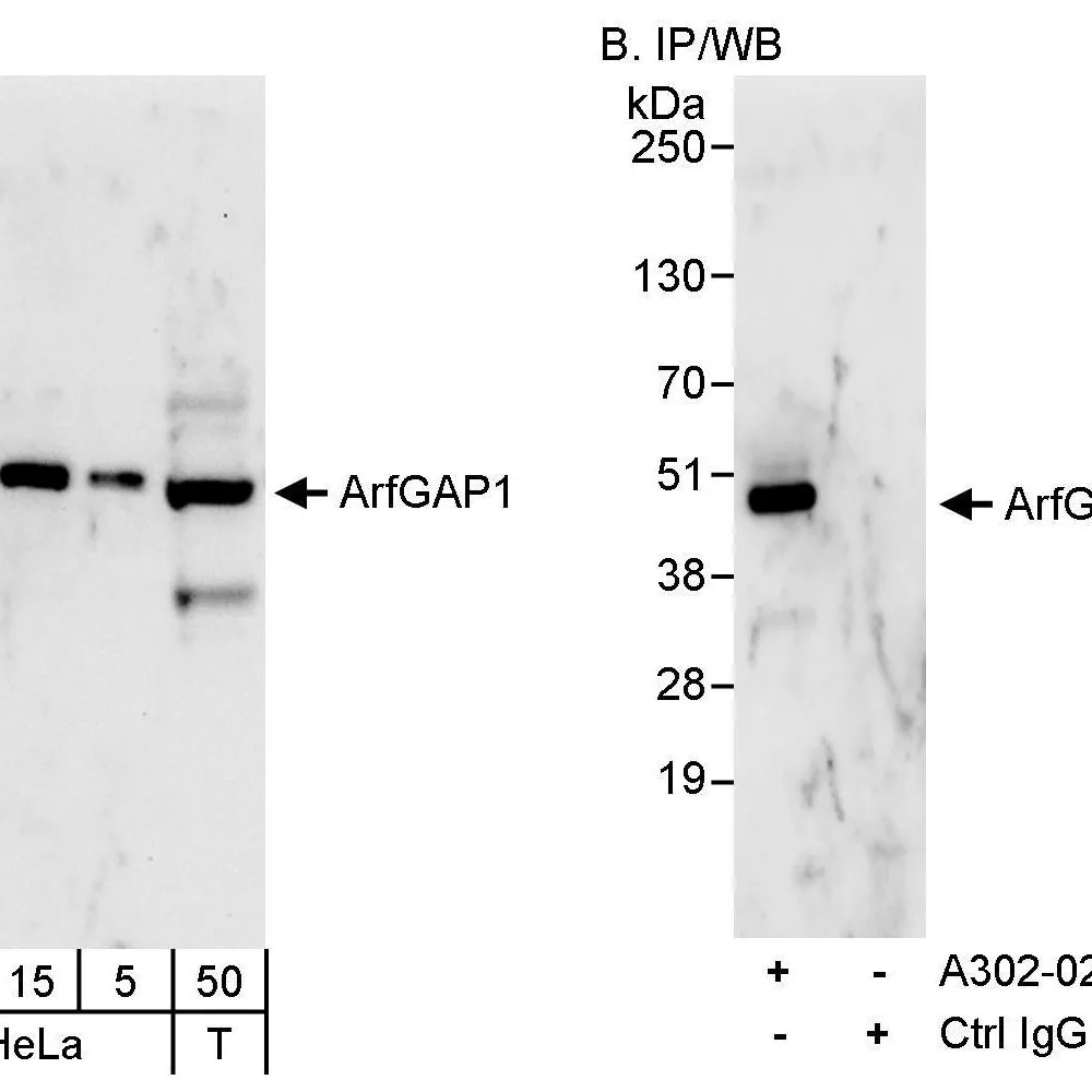 Rabbit anti-ArfGAP1 Antibody, Affinity Purified
