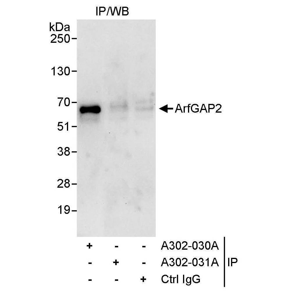 Rabbit anti-ArfGAP2 Antibody, Affinity Purified