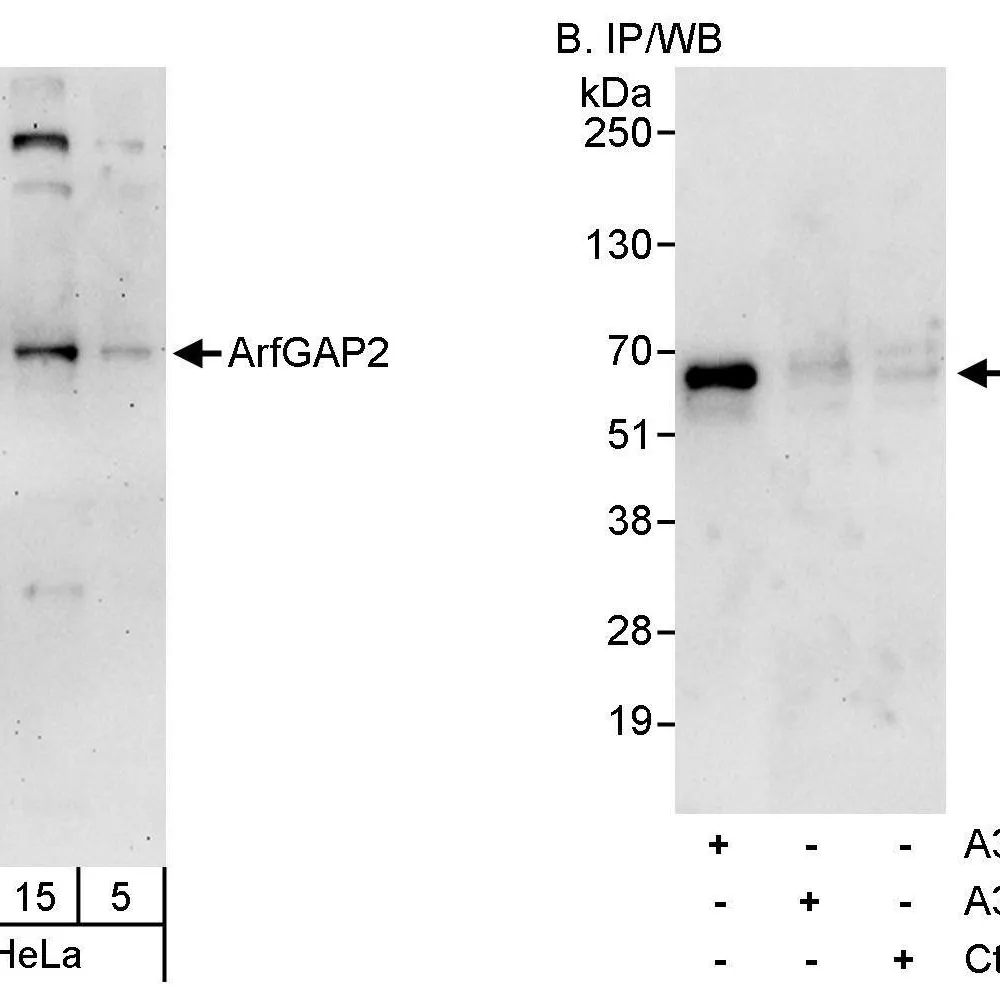 Rabbit anti-ArfGAP2 Antibody, Affinity Purified