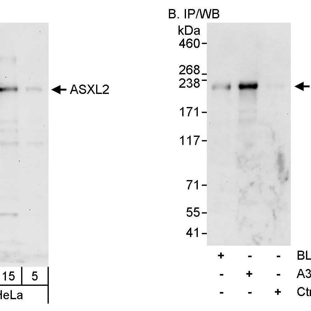 Rabbit anti-ASXL2 Antibody, Affinity Purified