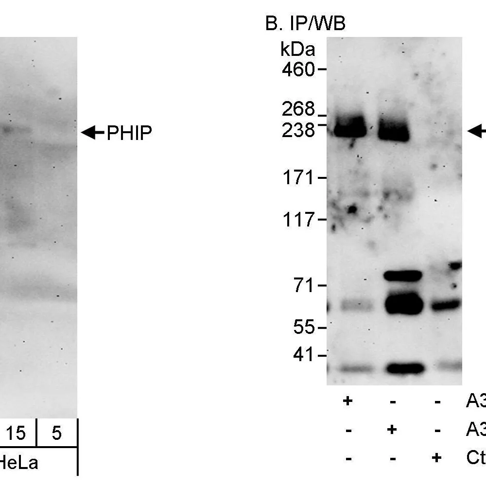 Rabbit anti-PHIP Antibody, Affinity Purified