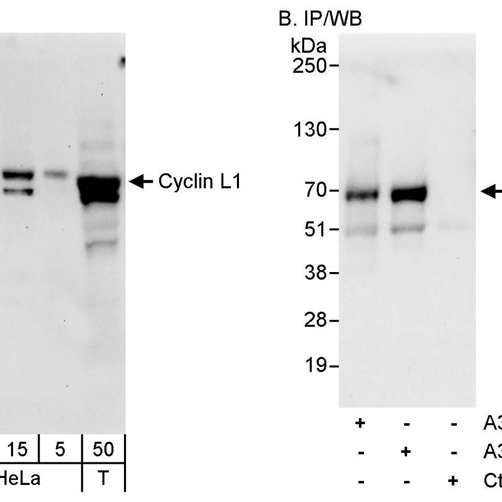 Rabbit anti-Cyclin L1 Antibody, Affinity Purified