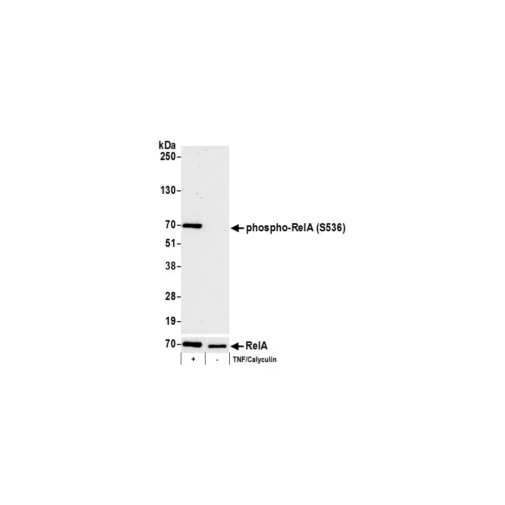 Rabbit anti-Phospho RelA (S536) Antibody, Affinity Purified