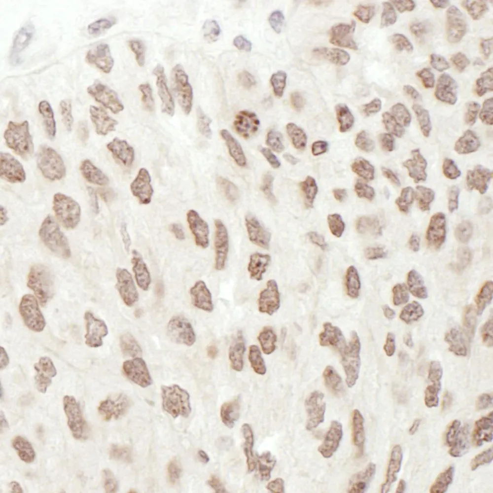 Rabbit anti-Phospho RelA (S468) Antibody, Affinity Purified