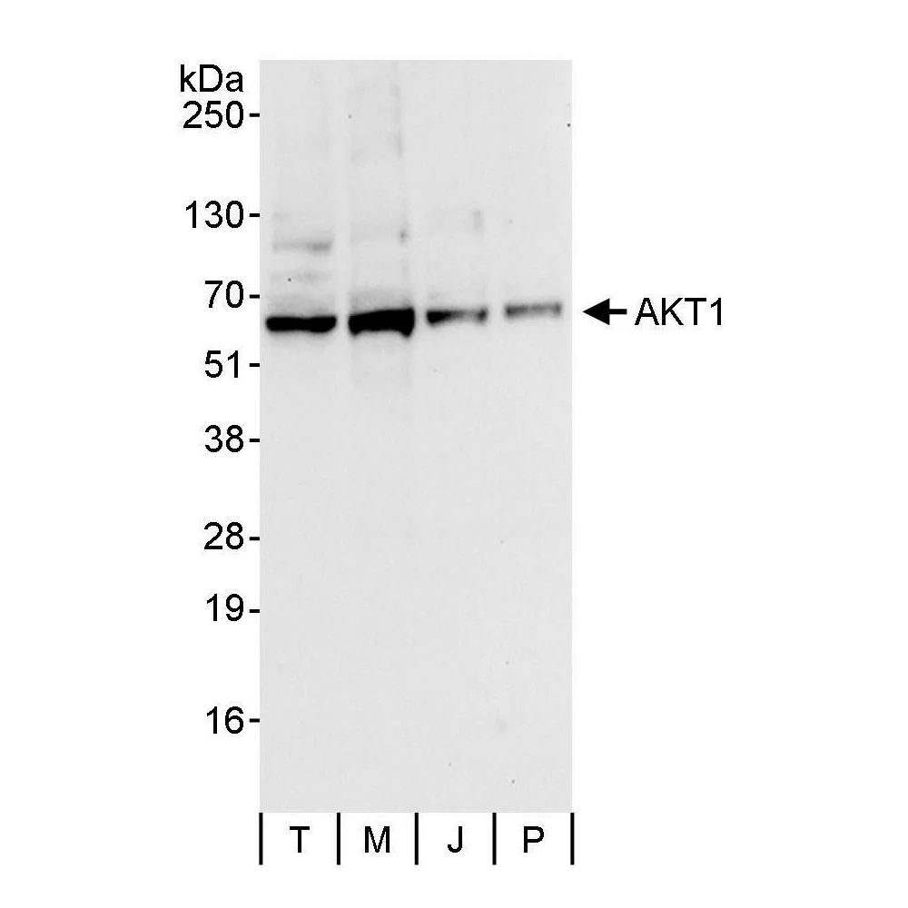 Rabbit anti-AKT1 Antibody, Affinity Purified