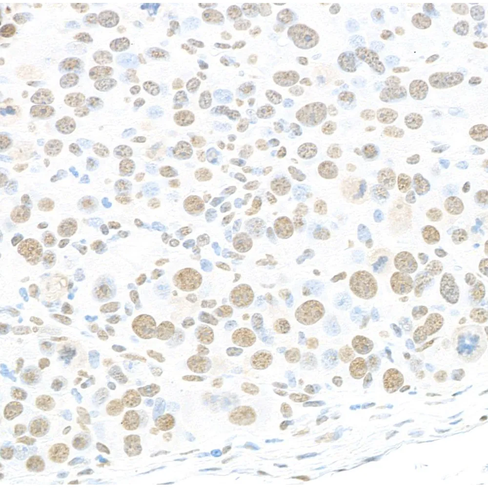 Rabbit anti-RALY Antibody, Affinity Purified