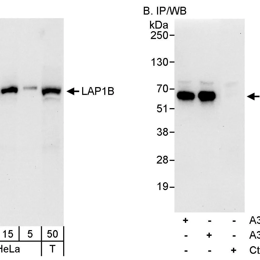 Rabbit anti-LAP1B Antibody, Affinity Purified