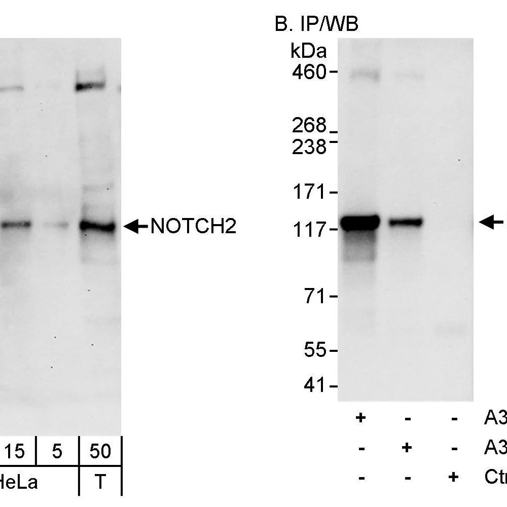 Rabbit anti-Notch2 Antibody, Affinity Purified