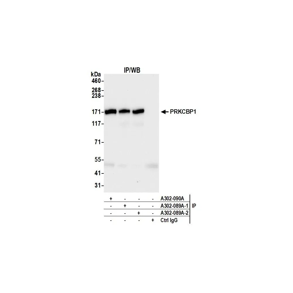 Rabbit anti-PRKCBP1 Antibody, Affinity Purified