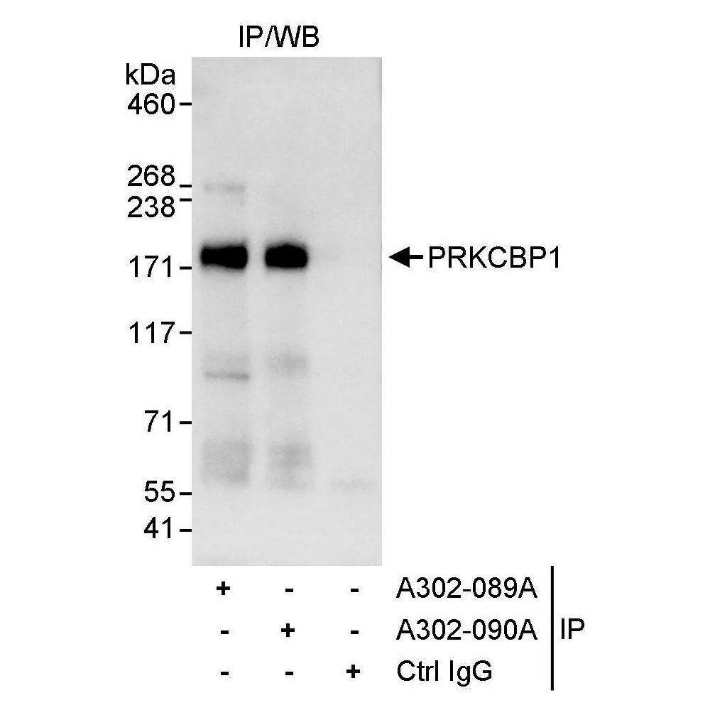 Rabbit anti-PRKCBP1 Antibody, Affinity Purified