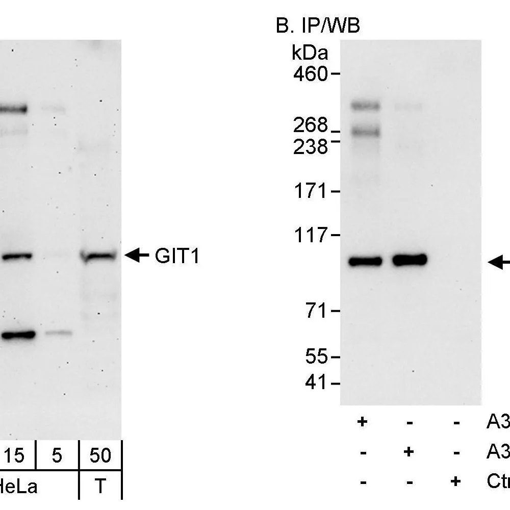 Rabbit anti-GIT1 Antibody, Affinity Purified