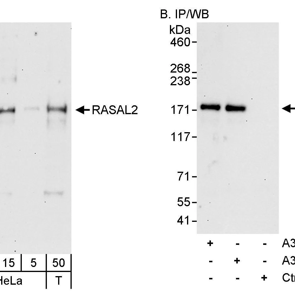 Rabbit anti-RASAL2 Antibody, Affinity Purified