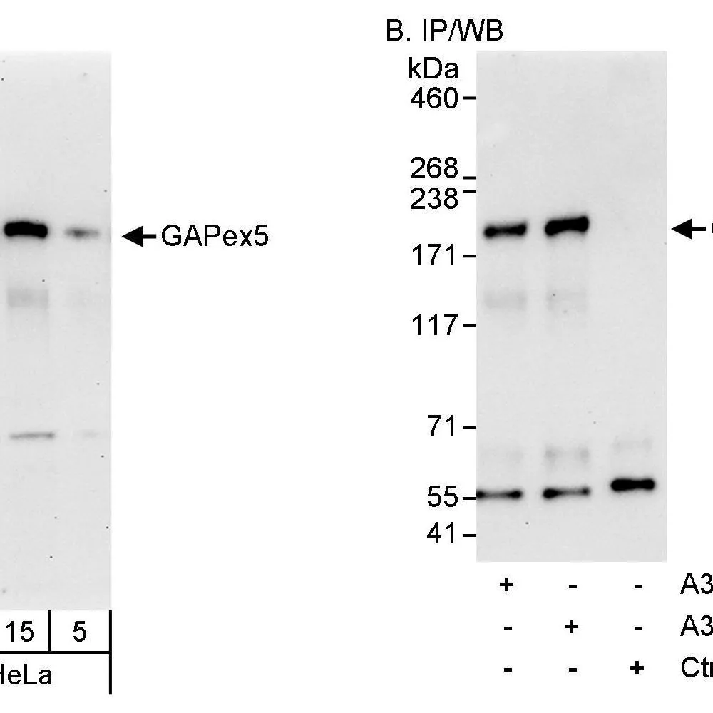 Rabbit anti-GAPex5 Antibody, Affinity Purified