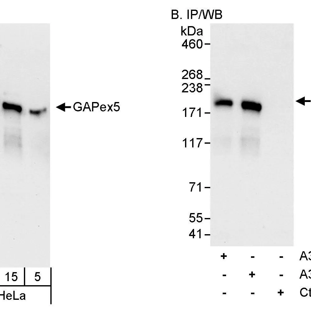 Rabbit anti-GAPex5 Antibody, Affinity Purified