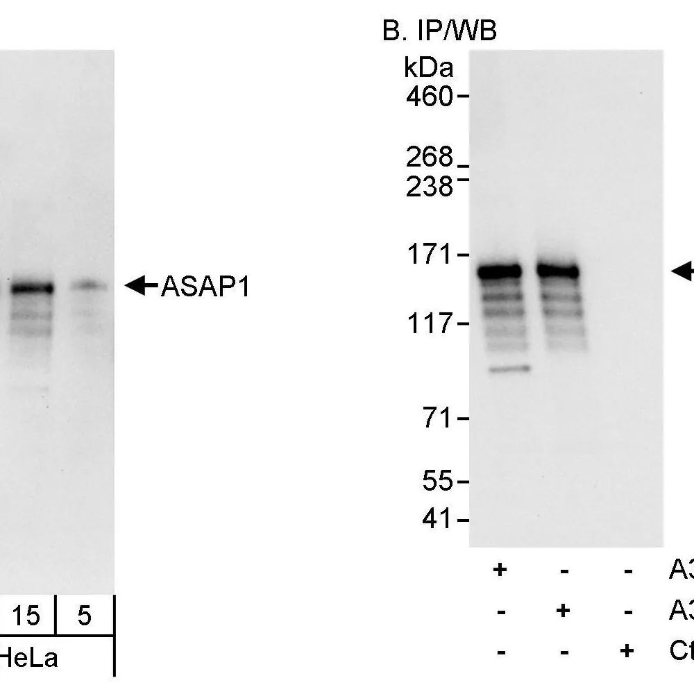 Rabbit anti-ASAP1 Antibody, Affinity Purified