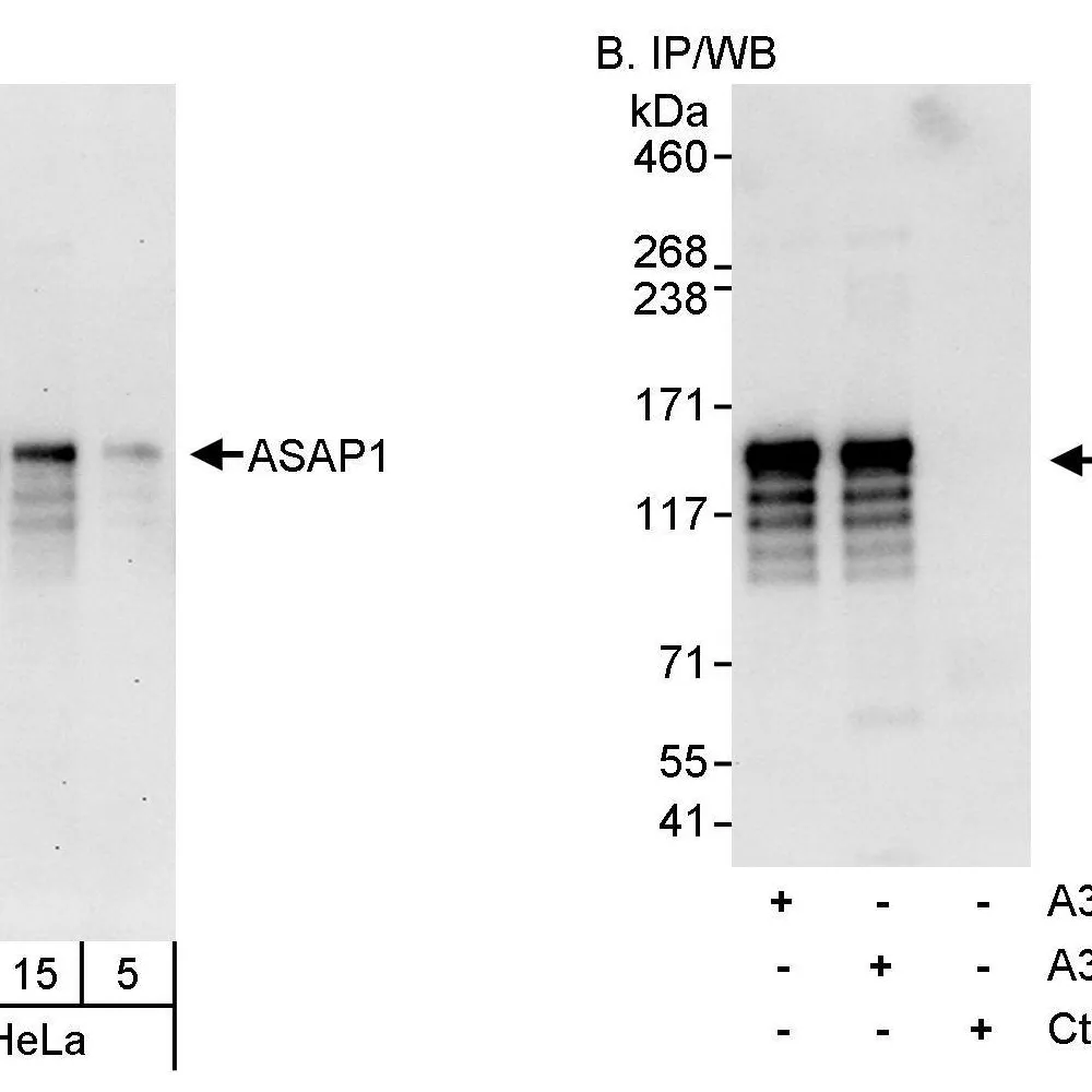 Rabbit anti-ASAP1 Antibody, Affinity Purified