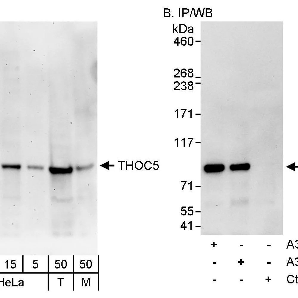 Rabbit anti-THOC5 Antibody, Affinity Purified