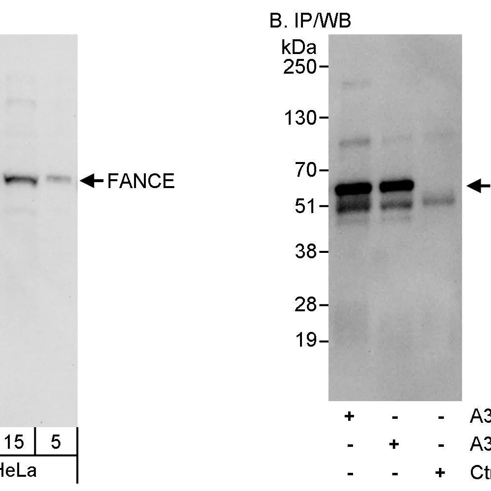 Rabbit anti-FANCE Antibody, Affinity Purified
