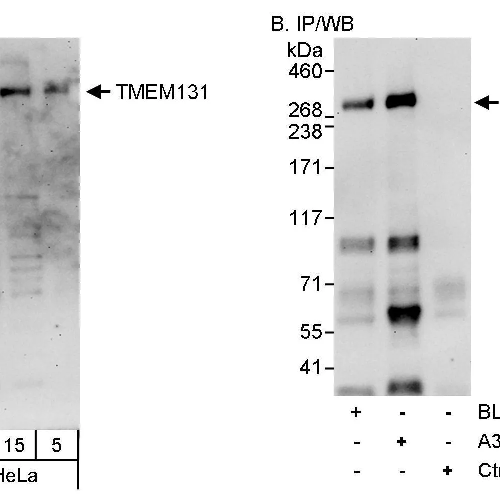 Rabbit anti-TMEM131 Antibody, Affinity Purified