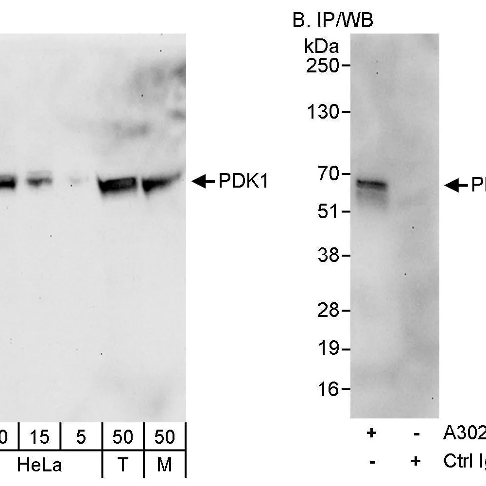 Rabbit anti-PDK1 Antibody, Affinity Purified