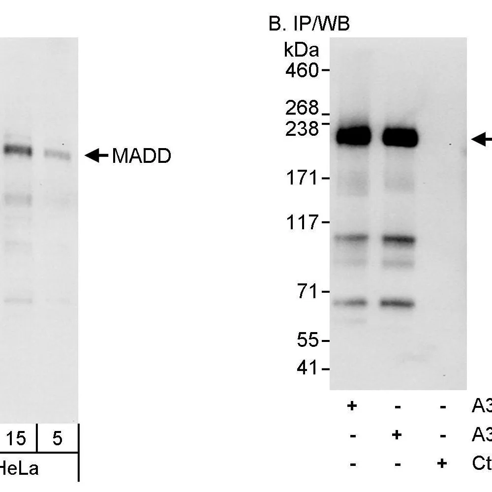 Rabbit anti-MADD Antibody, Affinity Purified