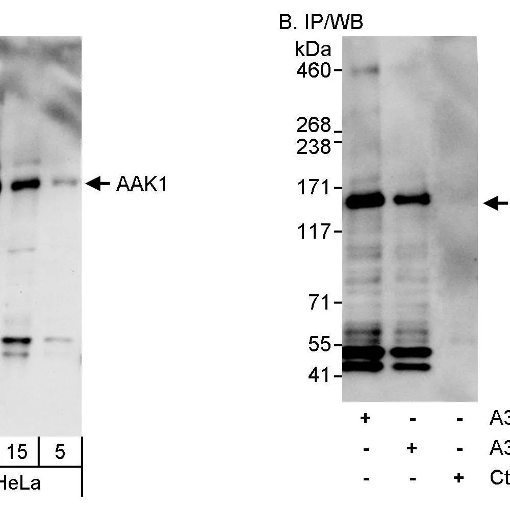 Rabbit anti-AAK1 Antibody, Affinity Purified