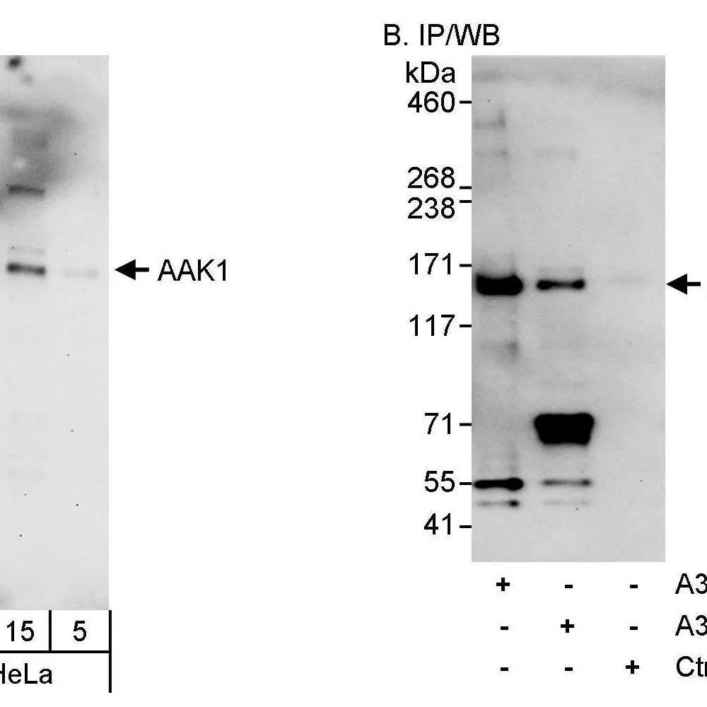Rabbit anti-AAK1 Antibody, Affinity Purified