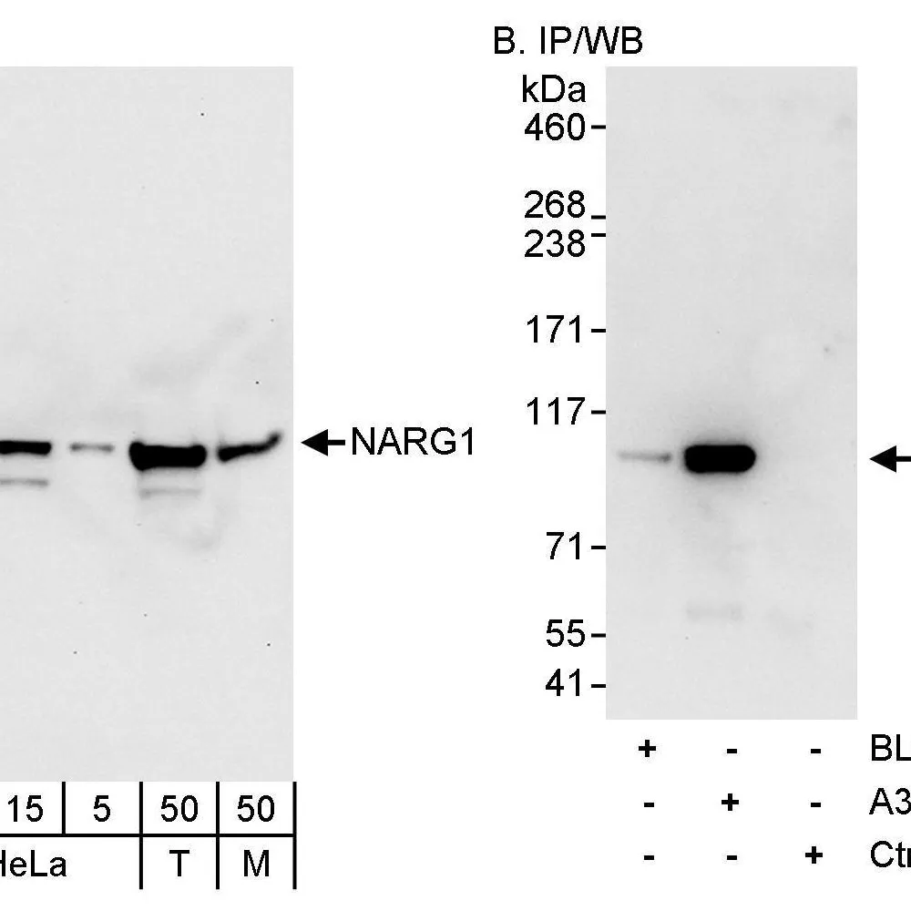 Rabbit anti-NARG1 Antibody, Affinity Purified