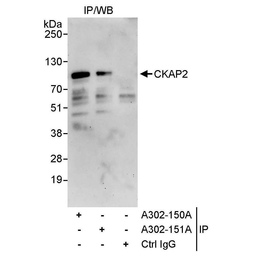 Rabbit anti-CKAP2 Antibody, Affinity Purified