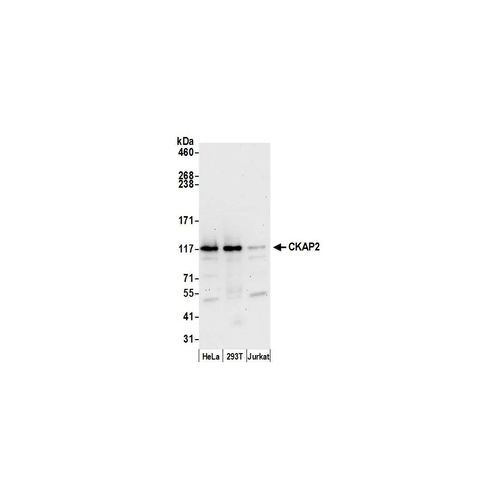 Rabbit anti-CKAP2 Antibody, Affinity Purified