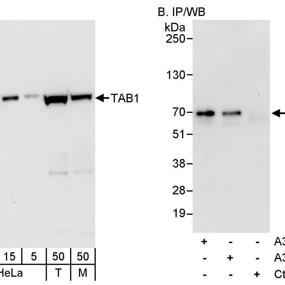 Rabbit anti-TAB1 Antibody, Affinity Purified