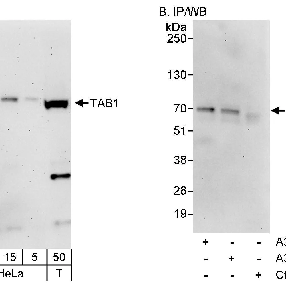 Rabbit anti-TAB1 Antibody, Affinity Purified