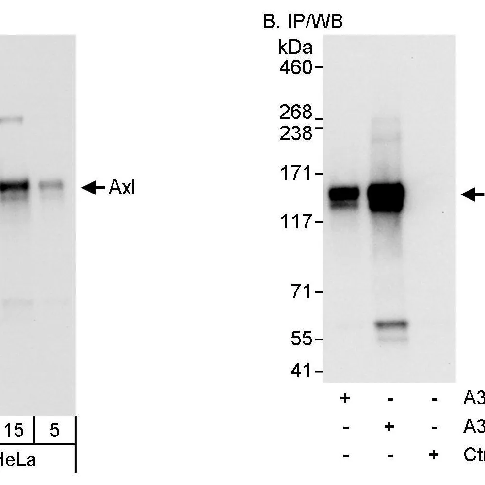 Rabbit anti-AXL Antibody, Affinity Purified