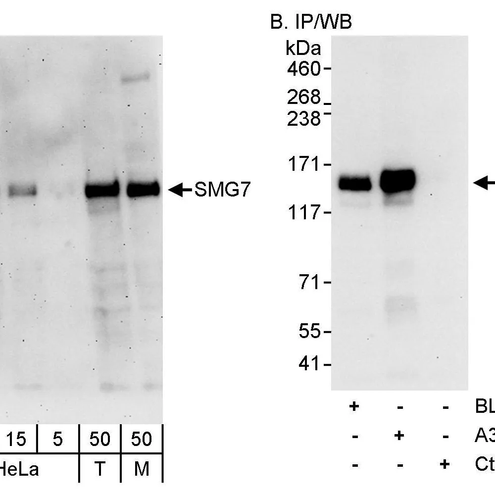 Rabbit anti-SMG7 Antibody, Affinity Purified
