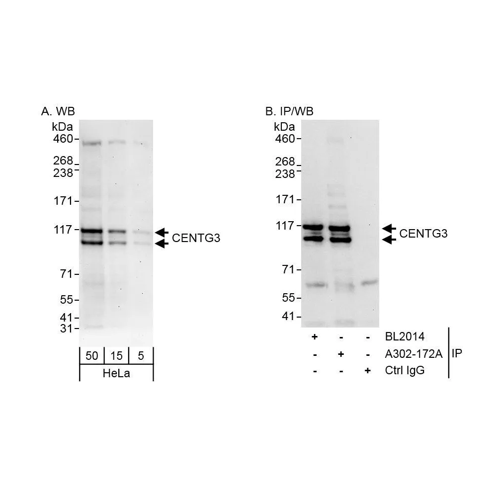 Rabbit anti-CENTG3 Antibody, Affinity Purified