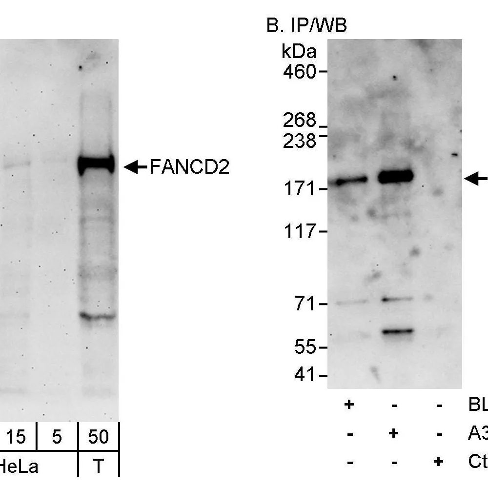Rabbit anti-FANCD2 Antibody, Affinity Purified